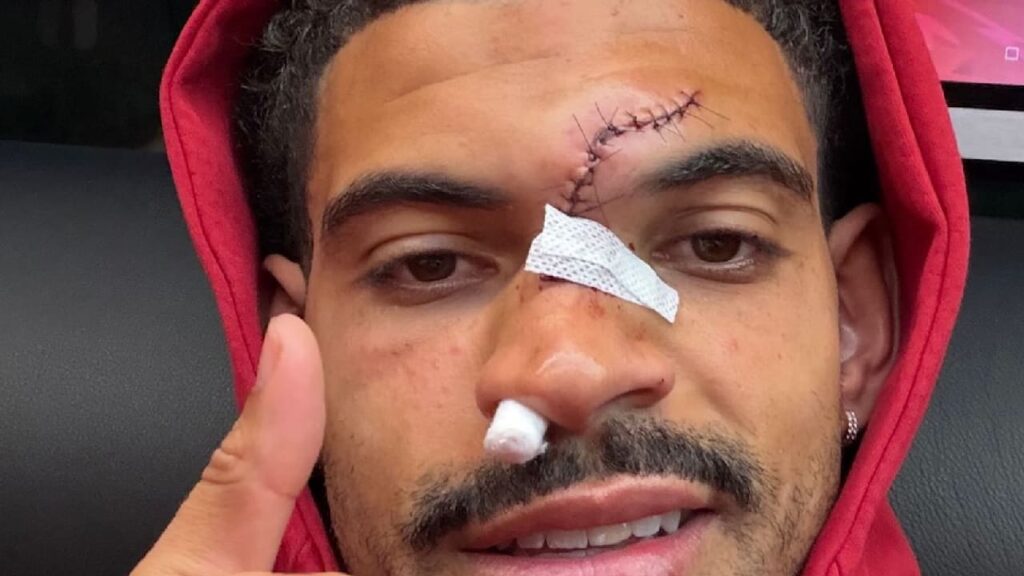 Premier League: Ylli i Anglisë, Morgan Gibbs-White tregon plagë të keqe pas përplasjes | sport
