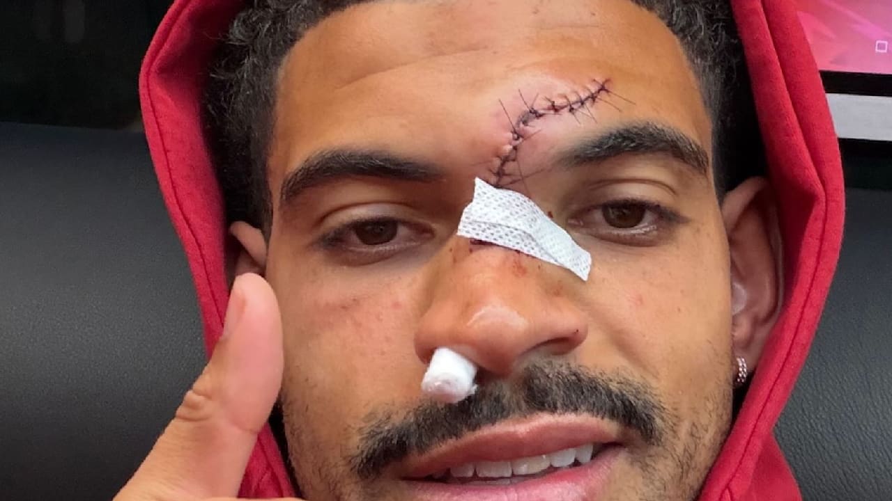 Premier League: Ylli i Anglisë, Morgan Gibbs-White tregon plagë të keqe pas përplasjes | sport